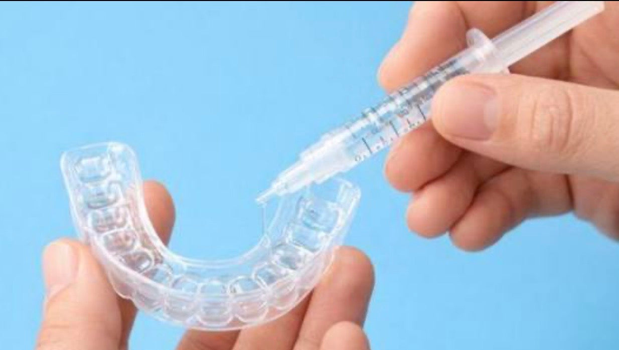 At Home Whitening Kit with Custom Trays